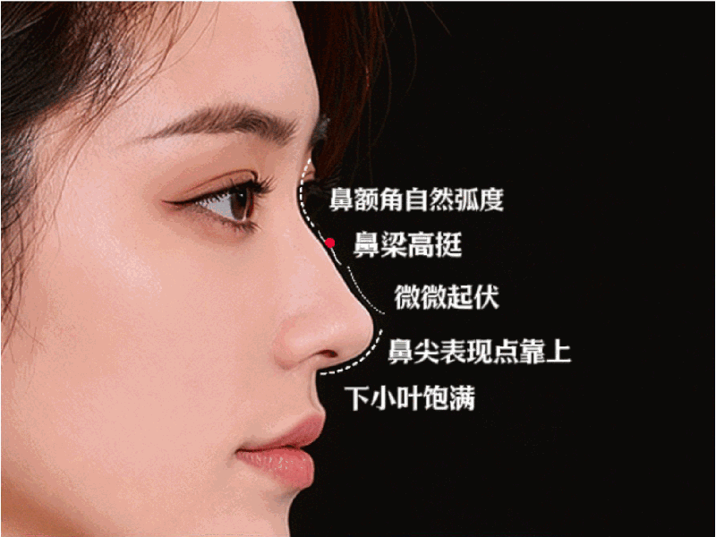 鼻部整形项目示意